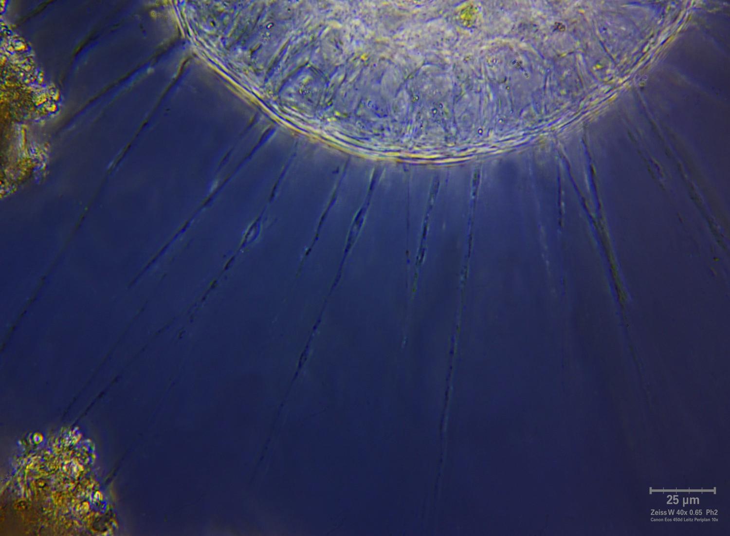 Actinosphaerium eichhorni - CdF
